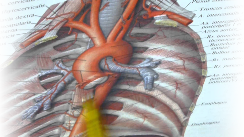 КТ- ангиография грудного отдела аорты и ее ветвей